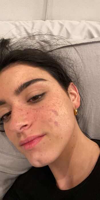 Dixie d amelio page leaked private photo uncensored HD quality
