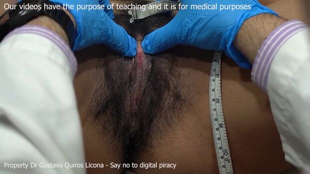 Dr gustavo quiros licona page leaked private photo uncensored HD quality
